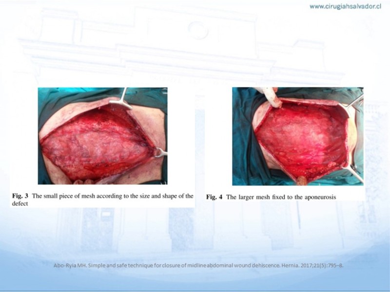 Diapositiva 51 de Manejo de la Evisceración