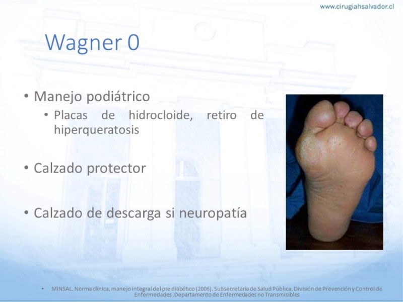 Diapositiva 24 de Manejo del Pie diabético