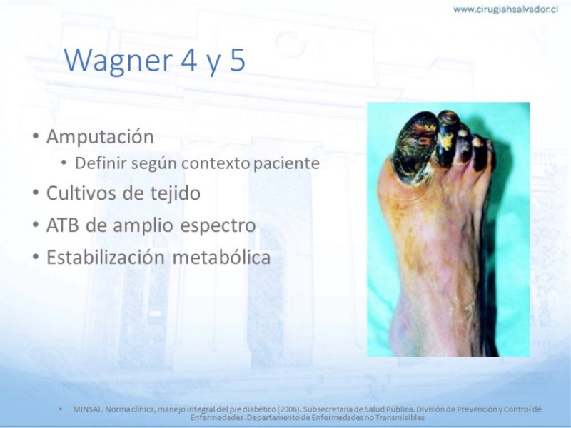 Diapositiva 28 de Manejo del Pie diabético