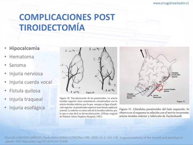 Diapositiva 8 de Hipocalcemia post Tiroidectomía