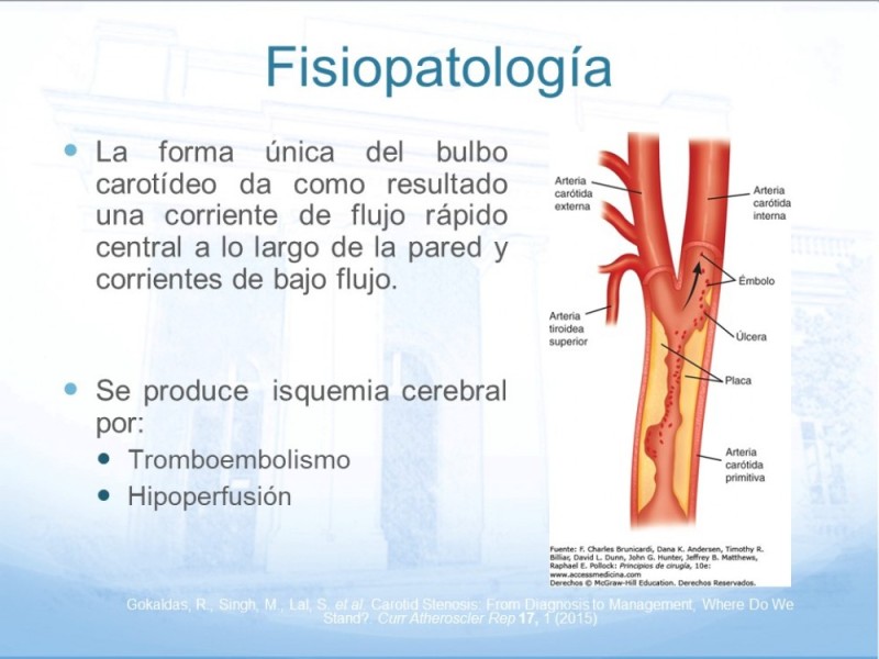 Diapositiva 6 de Estenosis Carotídea
