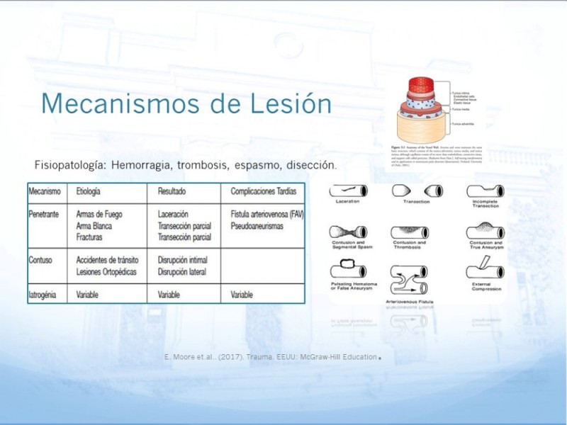 Diapositiva 6 de Manejo quirúrgico del pseudoaneurisma de extremidades