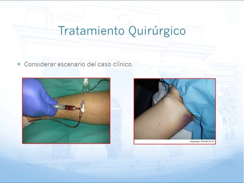 Diapositiva 20 de Manejo quirúrgico del pseudoaneurisma de extremidades
