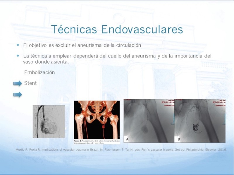 Diapositiva 18 de Manejo quirúrgico del pseudoaneurisma de extremidades