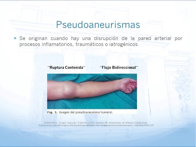 Diapositiva 5 de Manejo quirúrgico del pseudoaneurisma de extremidades
