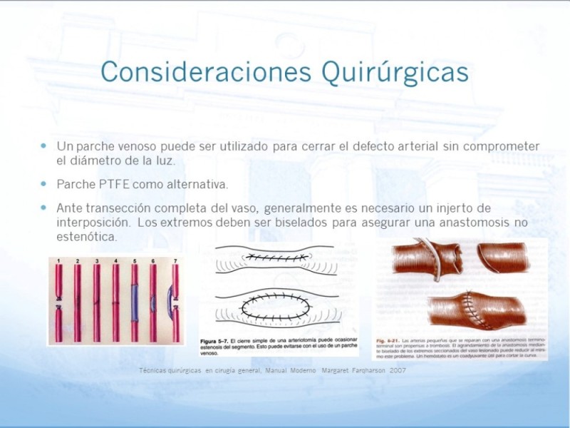 Diapositiva 28 de Manejo quirúrgico del pseudoaneurisma de extremidades