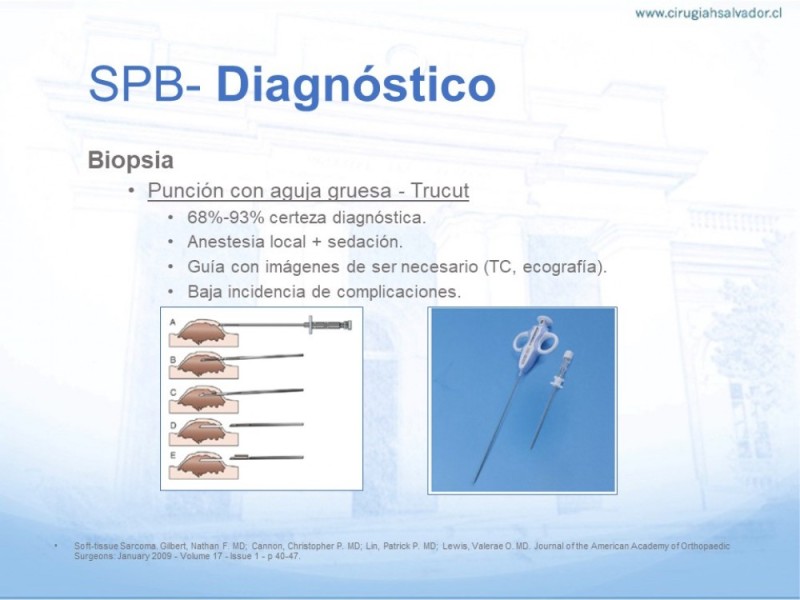 Diapositiva 8 de Sarcoma de partes blandas​