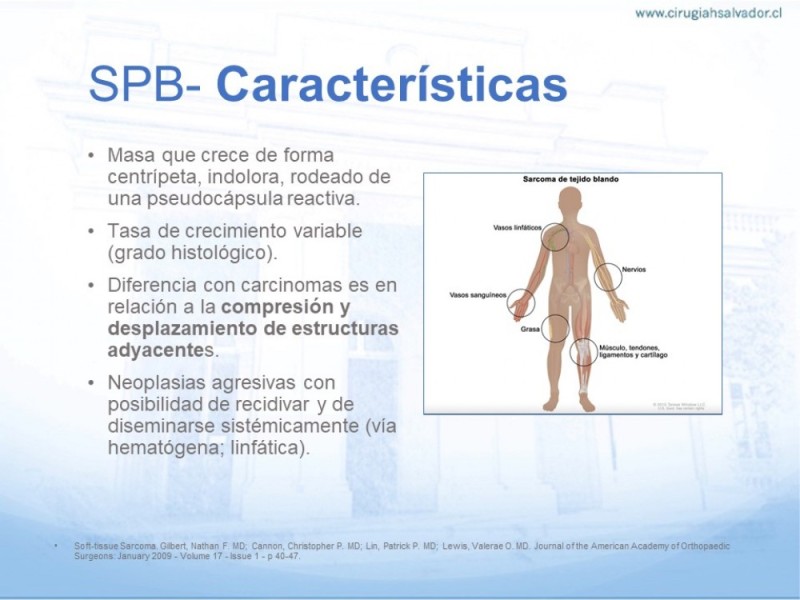 Diapositiva 2 de Sarcoma de partes blandas​