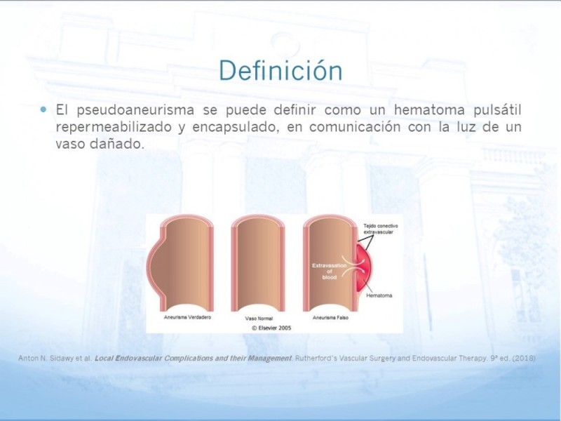 Diapositiva 3 de Manejo quirúrgico del pseudoaneurisma de extremidades