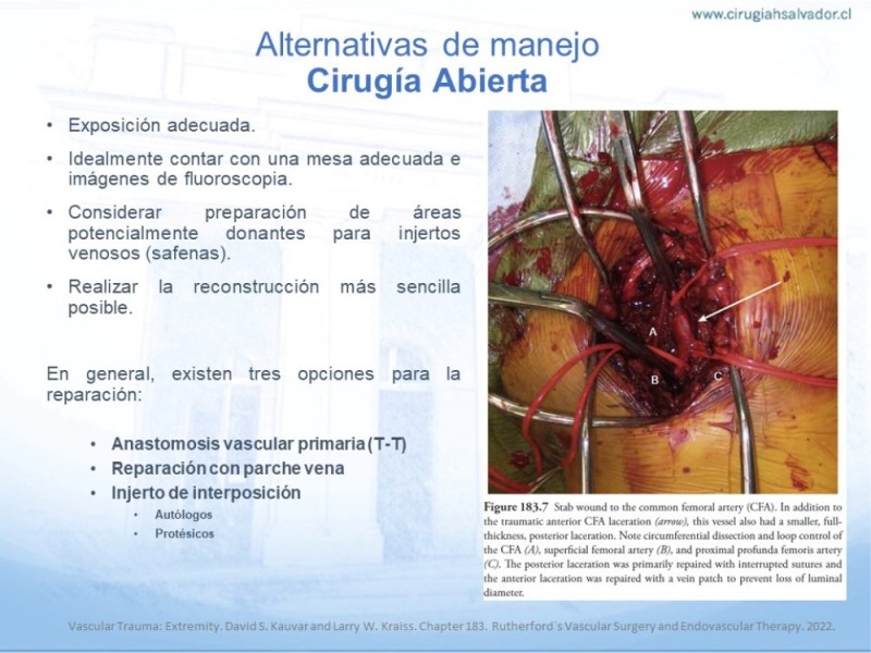Diapositiva 10 de Trauma Vascular en Extremidad Severamente Lesionada Técnicas de reparación