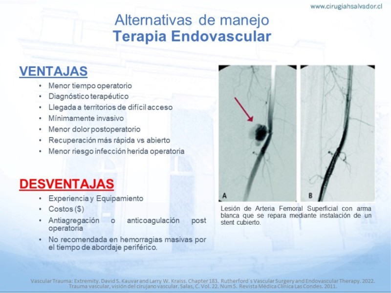 Diapositiva 29 de Trauma Vascular en Extremidad Severamente Lesionada Técnicas de reparación