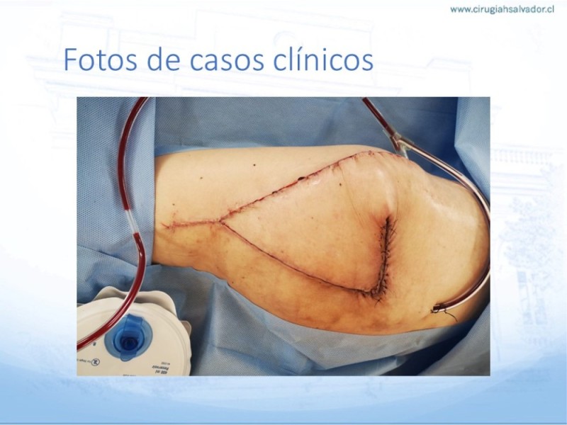 Diapositiva 41 de Lesiones por presión