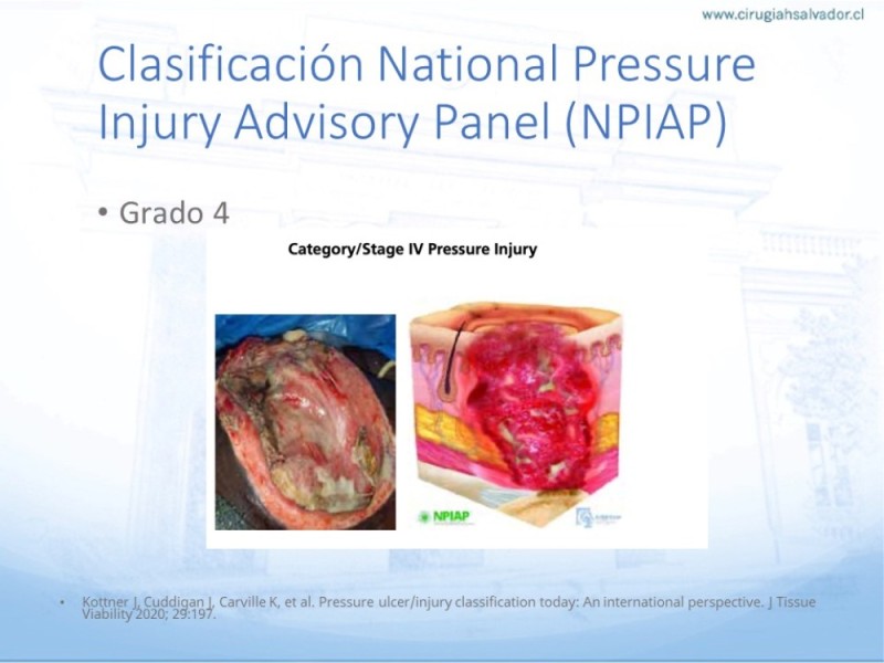 Diapositiva 17 de Lesiones por presión