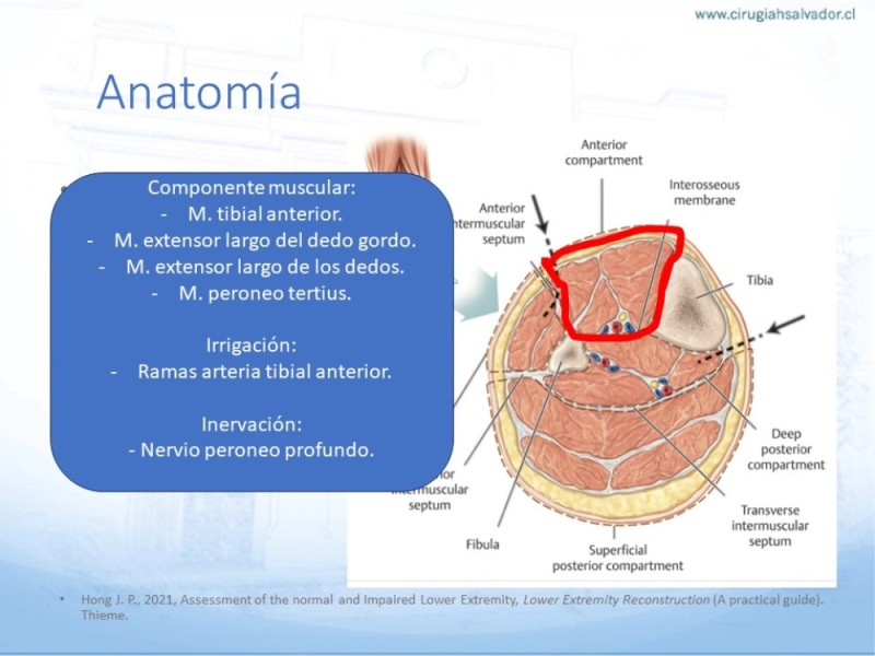 Diapositiva 8 de Reconstrucción miembro inferior