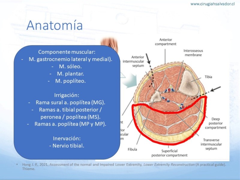 Diapositiva 10 de Reconstrucción miembro inferior