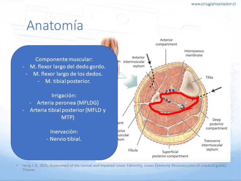Diapositiva 11 de Reconstrucción miembro inferior