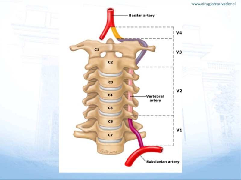 Diapositiva 17 de Trauma vascular cervical