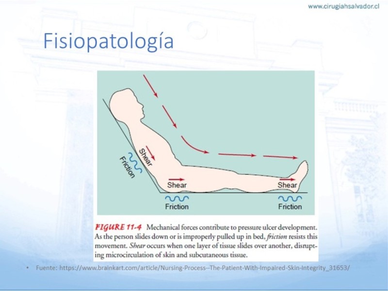 Diapositiva 7 de Lesiones por presión