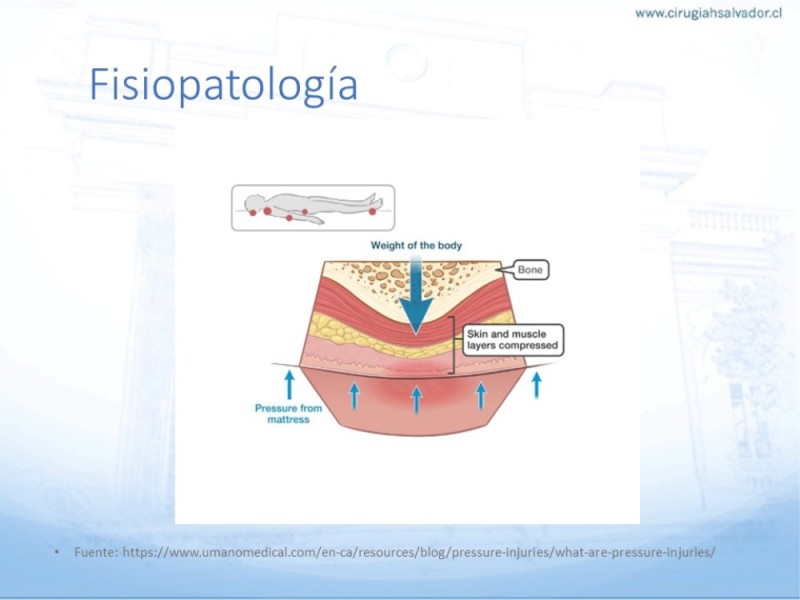Diapositiva 5 de Lesiones por presión