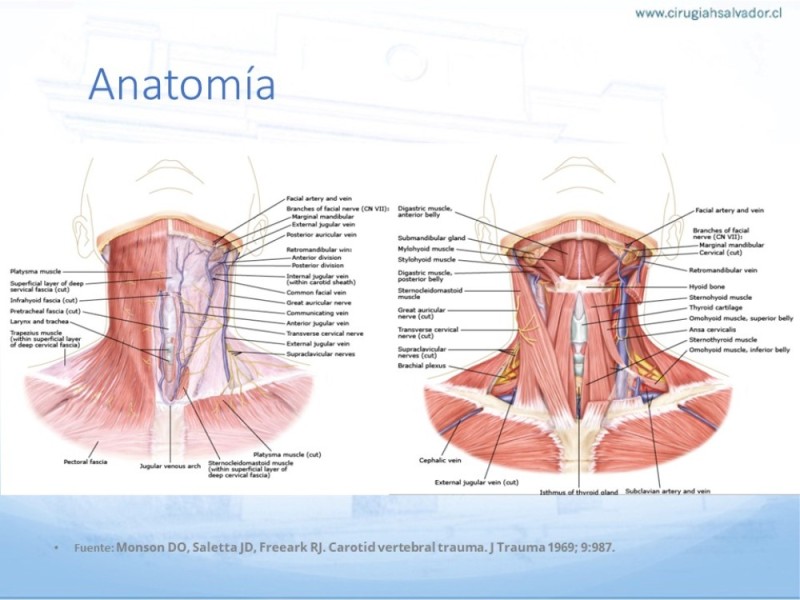 Diapositiva 3 de Trauma vascular cervical