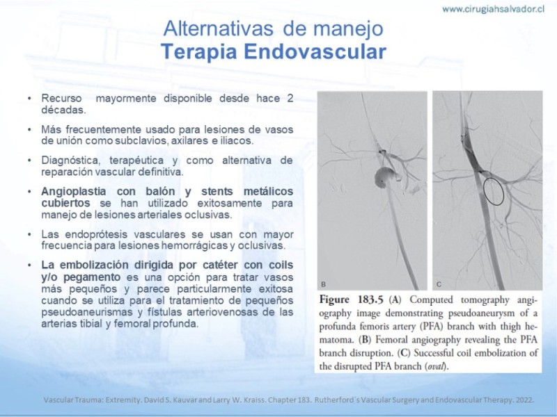 Diapositiva 27 de Trauma Vascular en Extremidad Severamente Lesionada Técnicas de reparación
