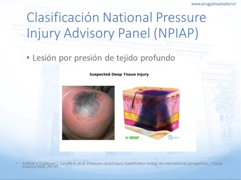 Diapositiva 19 de Lesiones por presión