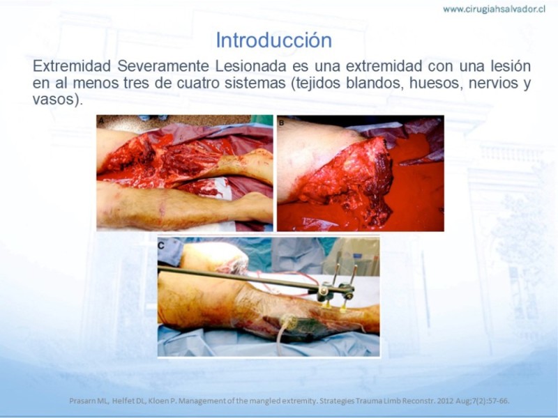 Diapositiva 1 de Trauma Vascular en Extremidad Severamente Lesionada Técnicas de reparación