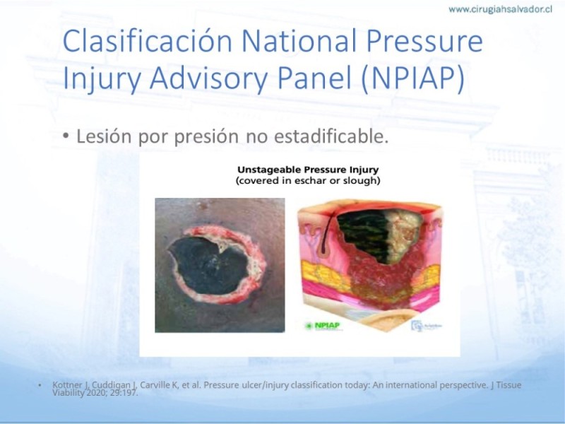Diapositiva 18 de Lesiones por presión
