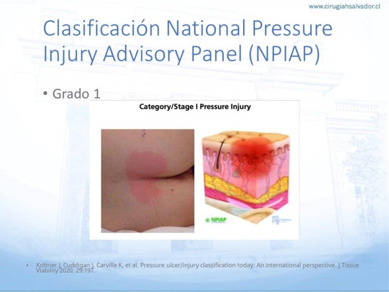 Diapositiva 14 de Lesiones por presión