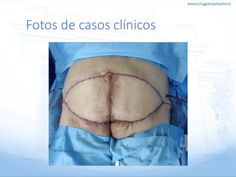 Diapositiva 36 de Lesiones por presión