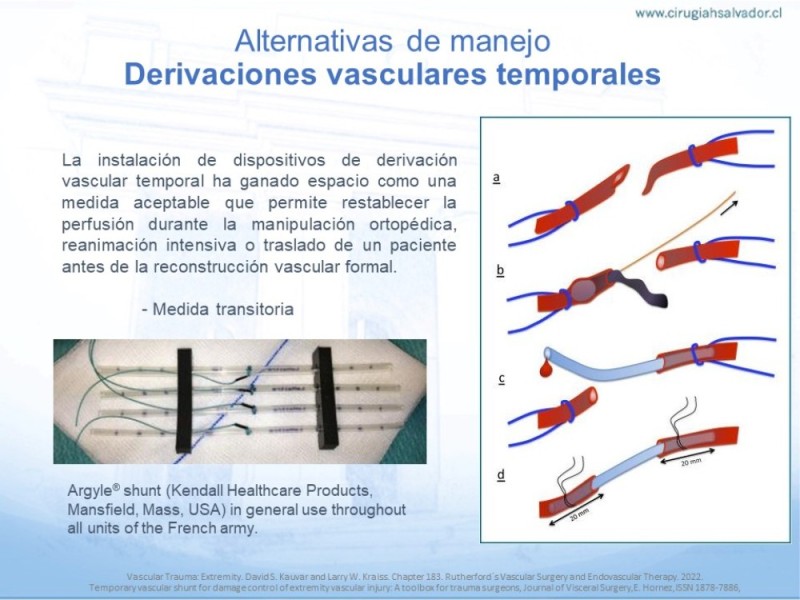 Diapositiva 16 de Trauma Vascular en Extremidad Severamente Lesionada Técnicas de reparación