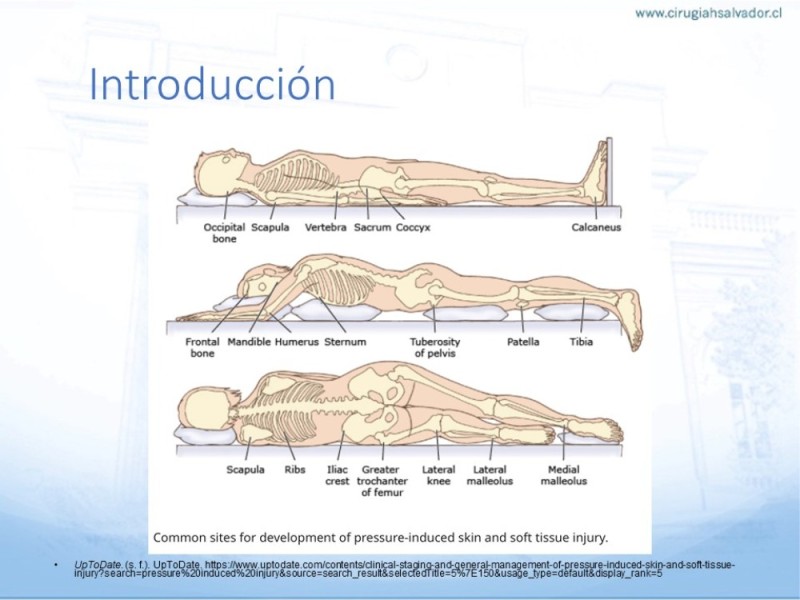 Diapositiva 2 de Lesiones por presión