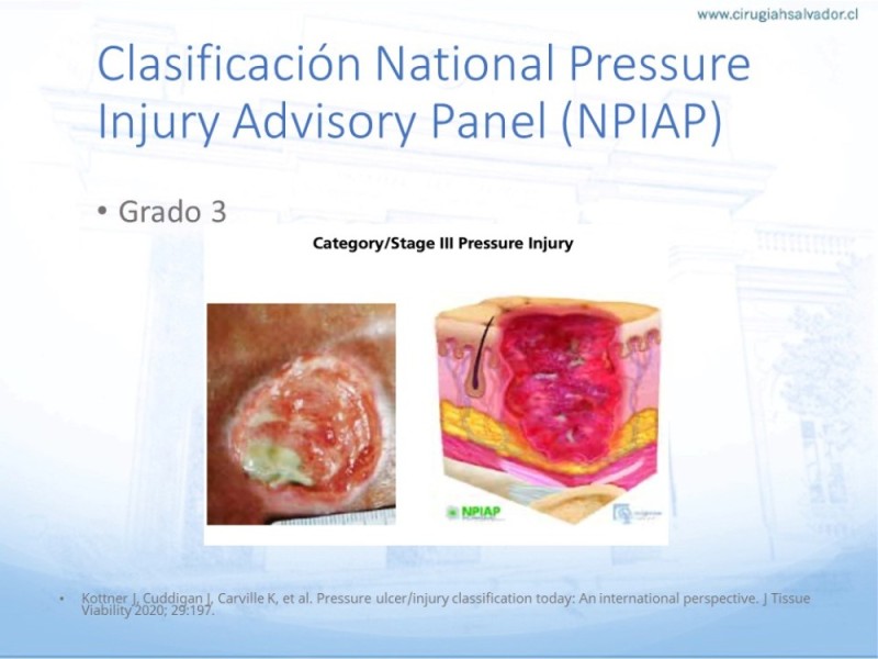 Diapositiva 16 de Lesiones por presión