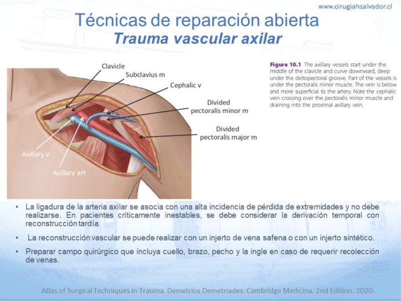 Diapositiva 19 de Trauma Vascular en Extremidad Severamente Lesionada Técnicas de reparación